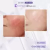Gel dưỡng phục hồi PANTHENOL 5% GEL CALMING &amp; SMOOTHES SKIN giúp làm dịu và dưỡng ẩm làn da The Gentinol 0221 50g 6