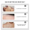 Găng tay tẩy tế bào chết Nhật Bản 2024 kỳ sạch ghét giảm mụn lưng hiệu quả cho cả nam và nữ -Việt Thư 3