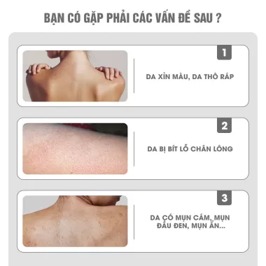 Găng tay tẩy tế bào chết Nhật Bản 2024 kỳ sạch ghét giảm mụn lưng hiệu quả cho cả nam và nữ -Việt Thư