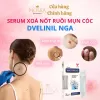 42 Miếng Dán Mụn Cóc Nhật – Dán Mụn Cóc, Mụn Thịt, Nốt Ruồi Big size - Wart Remover / Skin Tag Remover - giá sốc [f] 6