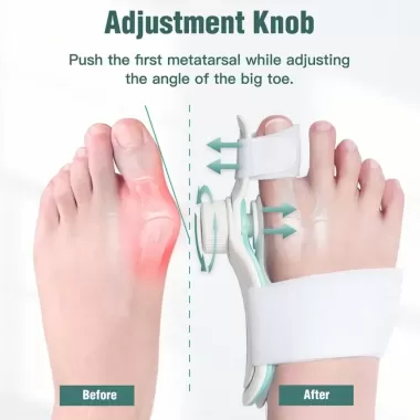 Cổ Tay Cái Tendon Miếng Dán Cho Ngón Tay Bảo Vệ Nẹp Ngón Chân Lớn Hallux Valgus Corrector Tay Chỉnh Hình Giảm Đau 4