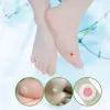 Miếng dán Giảm mụn cóc Sakura ( hộp 12 miếng) , giảm mụn cơm, trai chân, cực kì hiệu quả 5