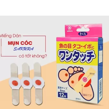 Miếng dán mụn cóc Sakura Nhật Bản loại bỏ mụn cóc, mụn cơm, trai chân hiệu quả
