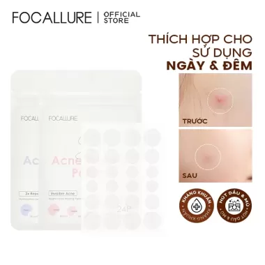 Miếng dán mụn FOCALLURE 2g tái tạo chăm sóc da tiện dụng cao cấp 1