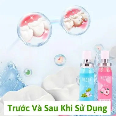 Xịt Thơm Miệng Hàn Quốc Giảm Hôi Miệng Ngăn Vi Khuẩn - Combo 2 Chỉ 42000đ
