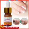 Serum Nấm Móng Tay Chân - Loại Bỏ Nhanh, Kháng Khuẩn, Miễn Phí Vận Chuyển