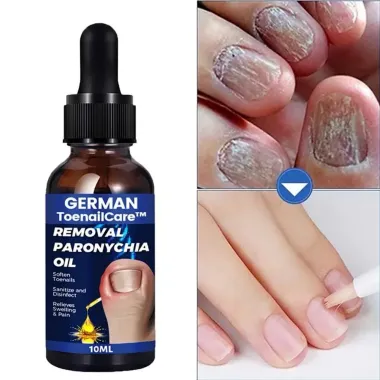 Serum Nấm Móng Tay Chân - Loại Bỏ Nhanh, Kháng Khuẩn, Miễn Phí Vận Chuyển 3