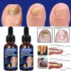 Serum Nấm Móng Tay Chân - Loại Bỏ Nhanh, Kháng Khuẩn, Miễn Phí Vận Chuyển 4