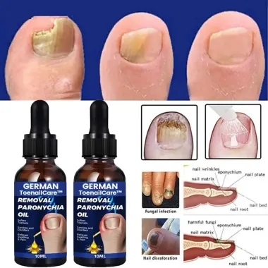 Serum Nấm Móng Tay Chân - Loại Bỏ Nhanh, Kháng Khuẩn, Miễn Phí Vận Chuyển 4