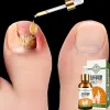 Serum Nấm Móng Tay Chân - Loại Bỏ Nhanh, Kháng Khuẩn, Miễn Phí Vận Chuyển 6