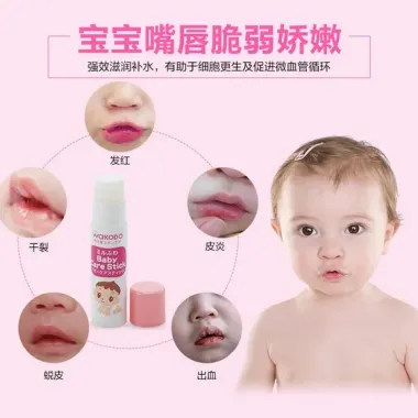 Son Dưỡng Môi Cho Bé Sơ Sinh Wakodo Nhật Bản 5g - Giảm Kích Ứng, Chống Khô Môi 5 Son Dưỡng Môi Cho Bé Sơ Sinh Wakodo Nhật Bản 5g - Giảm Kích Ứng, Chống Khô Môi 5