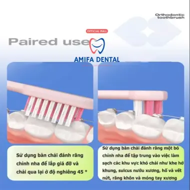 Bàn Chải Chỉnh Nha Chữ U Cho Niềng Răng - Giảm 22% còn 29500đ 10 Bàn Chải Chỉnh Nha Chữ U Cho Niềng Răng - Giảm 22% còn 29500đ 10