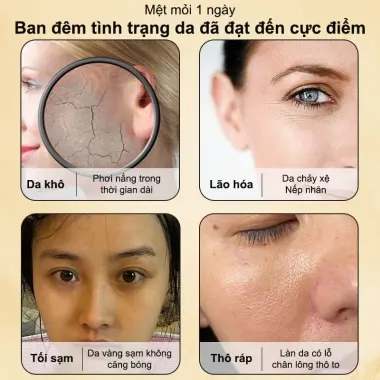 Mặt Nạ Thạch Collagen Cấp Ẩm Trắng Da Chống Nhăn 4ml*20PCS Miễn Rửa Giảm Giá 3 Mặt Nạ Thạch Collagen Cấp Ẩm Trắng Da Chống Nhăn 4ml*20PCS Miễn Rửa Giảm Giá 3