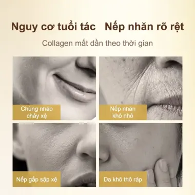 Mặt Nạ Thạch Collagen Cấp Ẩm Trắng Da Chống Nhăn 4ml*20PCS Miễn Rửa Giảm Giá 4 Mặt Nạ Thạch Collagen Cấp Ẩm Trắng Da Chống Nhăn 4ml*20PCS Miễn Rửa Giảm Giá 4