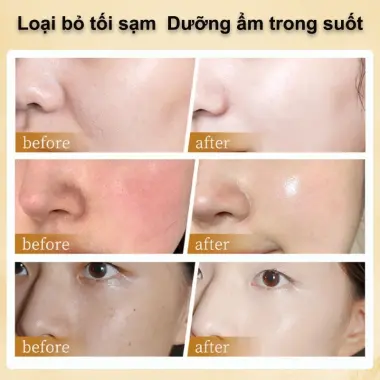 Mặt Nạ Thạch Collagen Cấp Ẩm Trắng Da Chống Nhăn 4ml*20PCS Miễn Rửa Giảm Giá 5 Mặt Nạ Thạch Collagen Cấp Ẩm Trắng Da Chống Nhăn 4ml*20PCS Miễn Rửa Giảm Giá 5