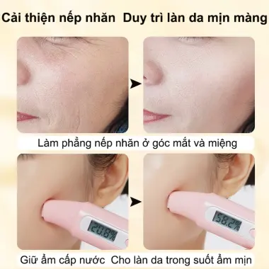 Mặt Nạ Thạch Collagen Cấp Ẩm Trắng Da Chống Nhăn 4ml*20PCS Miễn Rửa Giảm Giá 6 Mặt Nạ Thạch Collagen Cấp Ẩm Trắng Da Chống Nhăn 4ml*20PCS Miễn Rửa Giảm Giá 6