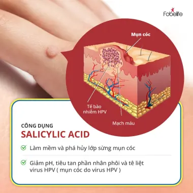 Miếng Dán Loại Bỏ Mụn Cóc Mụn Cơm KangDi Fobe - Giảm Mụn Hiệu Quả Chỉ 56k/hộp 6 Miếng 5