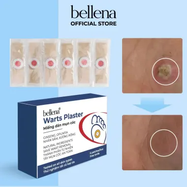 Miếng dán mụn cóc tẩy mụn cóc mụn thịt hiệu quả nhanh an toàn Bellena DC 2