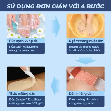 Miếng dán mụn cóc tẩy mụn cóc mụn thịt hiệu quả nhanh an toàn Bellena DC 8