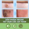 Miếng dán mụn cóc tẩy mụn cóc mụn thịt hiệu quả nhanh an toàn Bellena DC 9