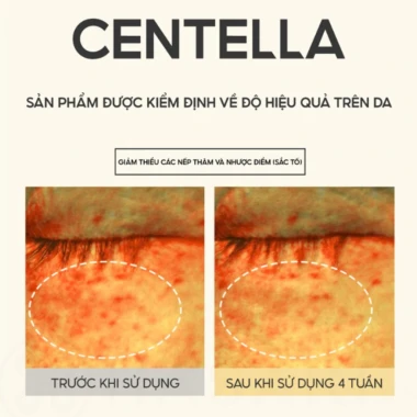 Combo Dr.Pepti Nước Hoa Hồng + Tinh Chất Dưỡng Trắng + Kem Dưỡng Ẩm - Giá giảm 352.000, gốc 436.480