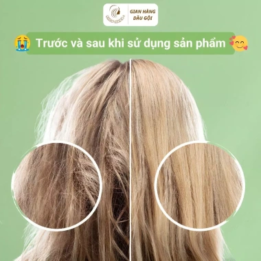 Dầu Gội Cặp Mishe Collagen Biotin 2.000ml SHOPHANA+ Dưỡng Tóc Kích Mọc Tóc Phục Hồi Tóc Hư Tổn Giảm Rụng Tóc Thơm Lâu