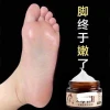 Kem ngựa nứt nẻ gót chân, giảm á sừng, bong da tái tạo da 3