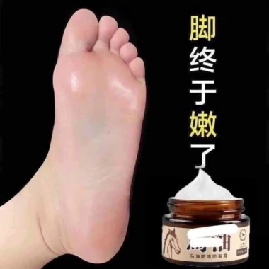 Kem ngựa nứt nẻ gót chân, giảm á sừng, bong da tái tạo da