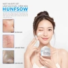 Mặt nạ đất sét HUNFSOW Kiểm soát dầu, se khít lỗ chân lông, giảm mụn đầu đen, giảm mụn, 3X Acid & Bùn trắng băng 110g 4
