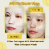 Mặt Nạ Thạch Collagen MediAnswer 5 miếng – Dưỡng trắng, chống lão hóa, chỉ 279,000 4