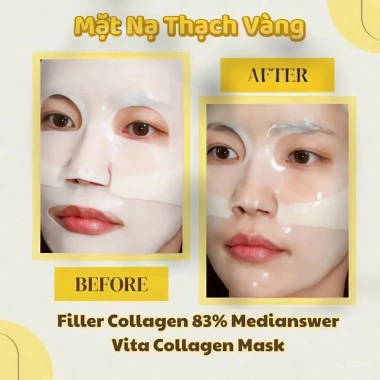 Mặt Nạ Thạch Collagen MediAnswer 5 miếng – Dưỡng trắng, chống lão hóa, chỉ 279,000