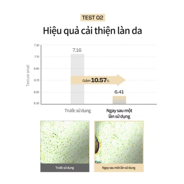 Nước hoa hồng d'Alba Vita Toner 180ml - Toning Serum cấp ẩm sáng da chỉ 159.000 VNĐ