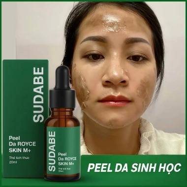 Peel da ROYCE SKIN M+ - Bong mảng, tàn nhang, sẹo, rỗ lõm, mụn thâm, giá 262.500đ 4