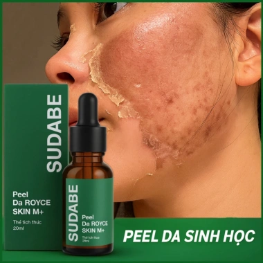 Peel da ROYCE SKIN M+ - Bong mảng, tàn nhang, sẹo, rỗ lõm, mụn thâm, giá 262.500đ 5