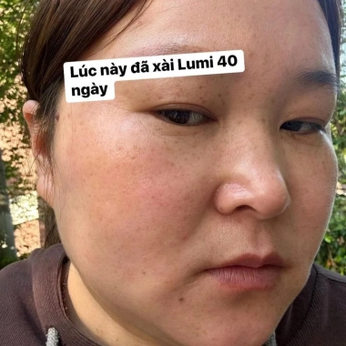 Serum Lumi Arbutin 50ml - Cấp ẩm, Làm dịu, Da mềm mịn, Sáng khỏe - Giá 250k