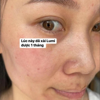 Serum Lumi Arbutin 50ml - Cấp ẩm, Làm dịu, Da mềm mịn, Sáng khỏe - Giá 250k 3 Serum Lumi Arbutin 50ml - Cấp ẩm, Làm dịu, Da mềm mịn, Sáng khỏe - Giá 250k 3