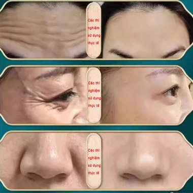 Serum trắng da mờ thâm, chống lão hoá và xóa nếp nhăn cao sâm, giá chỉ 135.000đ 4