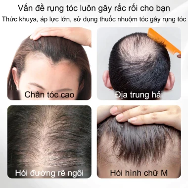 Thảo Dược Mộc Tóc Serum Dưỡng Tóc Chống Rụng, Kích Mọc Nhanh – Giá Chỉ 87.000 2