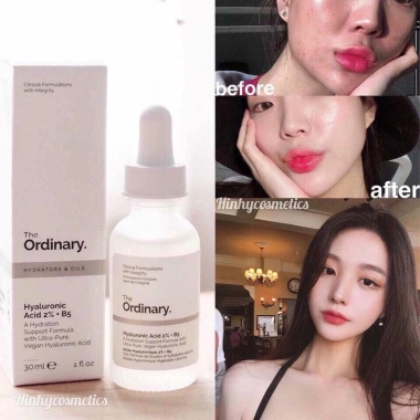 The Ordinary Niacinamide 10% + Zinc 1% 30ml - Tinh Chất Cho Da Mụn, Se Khít Lỗ Chân Lông, Sáng Da 2 The Ordinary Niacinamide 10% + Zinc 1% 30ml - Tinh Chất Cho Da Mụn, Se Khít Lỗ Chân Lông, Sáng Da 2