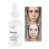 The Ordinary Niacinamide 10% + Zinc 1% 30ml - Tinh Chất Cho Da Mụn, Se Khít Lỗ Chân Lông, Sáng Da 3