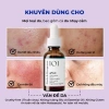 Tinh chất aPAD 20% Azelaic Acid 30ml - Mờ thâm, dưỡng sáng, kiểm soát dầu - 419k 6