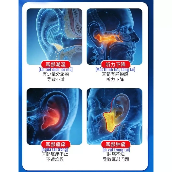 Hình ảnh sản phẩm 10 Miếng Dán Thảo Mộc Nhật Bản - Dán ủ tai giảm đau, viêm tai, giá chỉ 123k