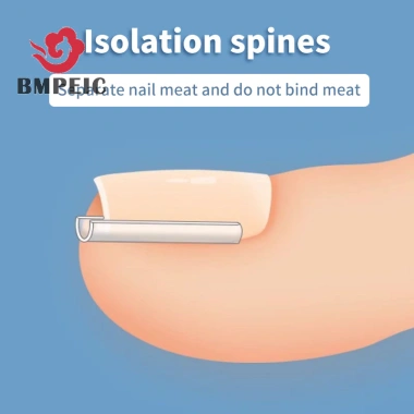Bmpeic 50 Cái Dụng cụ chỉnh sửa móng chân mọc ngược Ngón chân Điều trị móng tay Miếng dán đàn hồi Miếng dán thẳng Kẹp Nẹp Dụng cụ làm móng chân mới 4