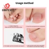 Bmpeic 50 Cái Dụng cụ chỉnh sửa móng chân mọc ngược Ngón chân Điều trị móng tay Miếng dán đàn hồi Miếng dán thẳng Kẹp Nẹp Dụng cụ làm móng chân mới 5