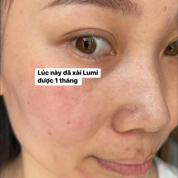 Hình ảnh sản phẩm Combo Kem Nám Lumi Arbutin Ngày Đêm Mờ Thâm Sáng Da Đều Màu - Chỉ 299.000 VND