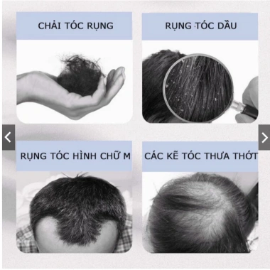 Dầu Gội Kích Mọc Tóc QIWEITANG – Dầu Gội QWEITANG Nhân Sâm Giảm Rụng, Kích Mọc Tóc Đen, Chắc Khỏe Từ Gốc 350ml