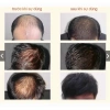 Dầu Gội Kích Mọc Tóc QIWEITANG – Dầu Gội QWEITANG Nhân Sâm Giảm Rụng, Kích Mọc Tóc Đen, Chắc Khỏe Từ Gốc 350ml 4