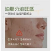Han Lun Meiyu Thanh Niên Sữa Rửa Mặt Loại Bỏ Mụn Đầu Đen, Làm Sạch Sâu 7