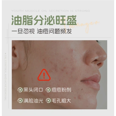 Han Lun Meiyu Thanh Niên Sữa Rửa Mặt Loại Bỏ Mụn Đầu Đen, Làm Sạch Sâu