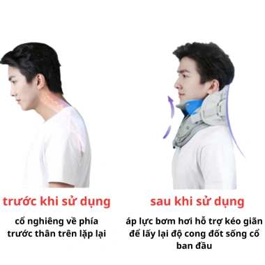 i Hơi Kéo Dãn Cổ VIETMED PMA-L30 | Hỗ Trợ Thoát Vị – Thoái Hóa Đốt Sống Cổ | Nẹp Cố Định – Nén Nhiệt Giảm Đau Vai Gáy 3
